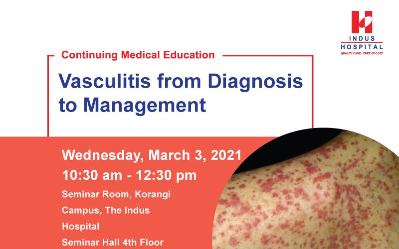 Vasculitis from diagnosis to management